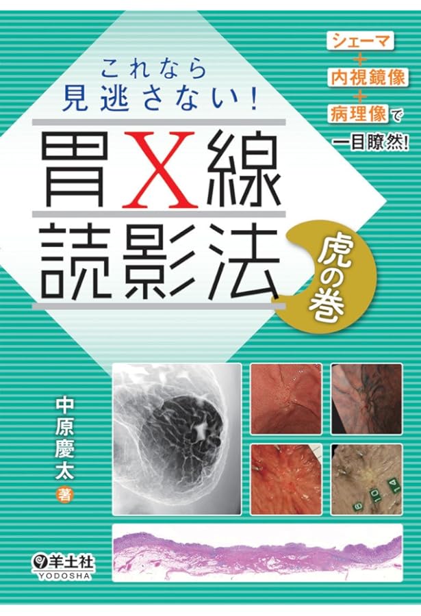 胃X線診断の考え方と進め方 | 市川 平三郎, 吉田 裕司 |本 | 通販 | Amazon